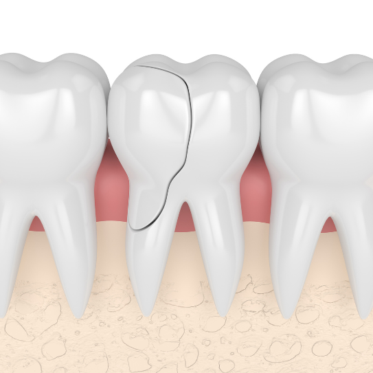endodontist in las vegas